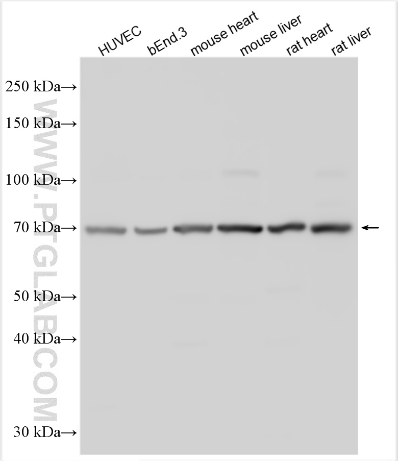 WB analysis using 28321-1-AP (same clone as 28321-1-PBS)