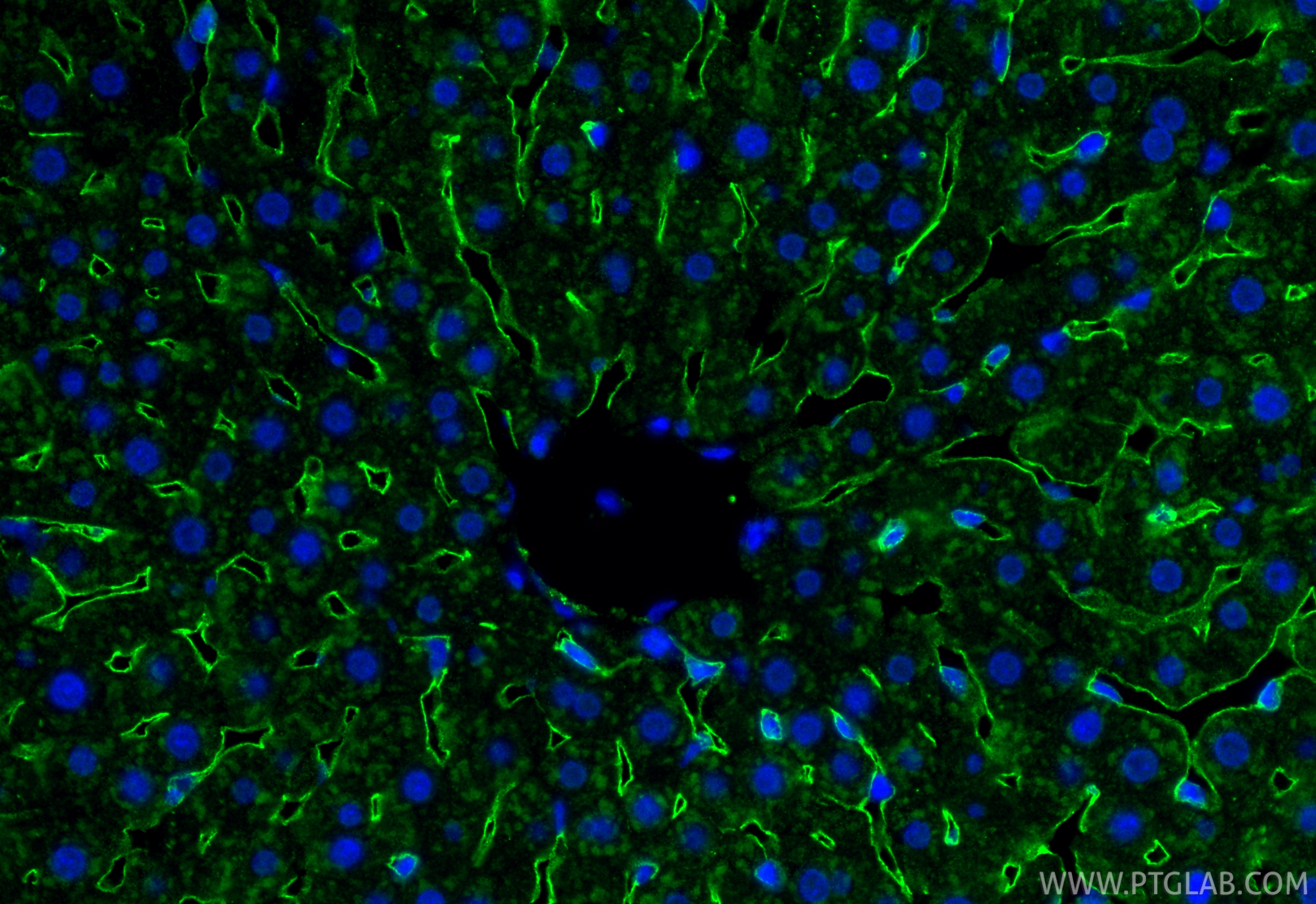 IF Staining of rat liver using 34236-1-AP IF Staining of rat liver using 34236-1-AP
