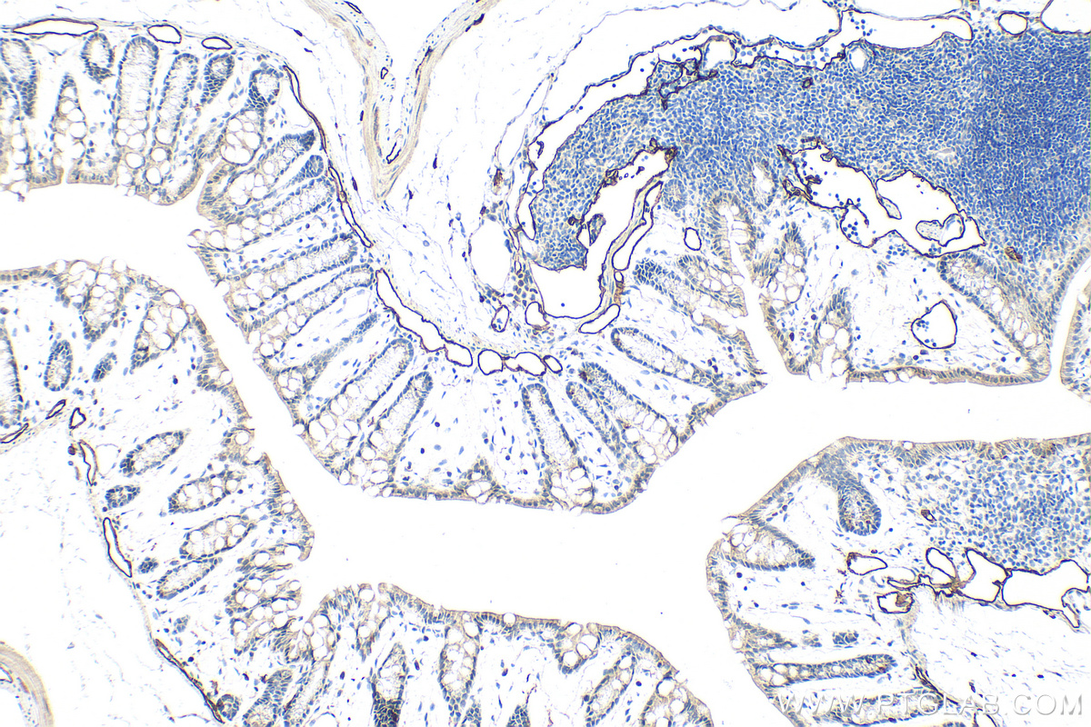 IHC staining of mouse colon using 34236-1-AP IHC staining of mouse colon using 34236-1-AP