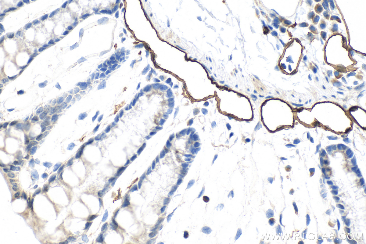 IHC staining of mouse colon using 34236-1-AP IHC staining of mouse colon using 34236-1-AP