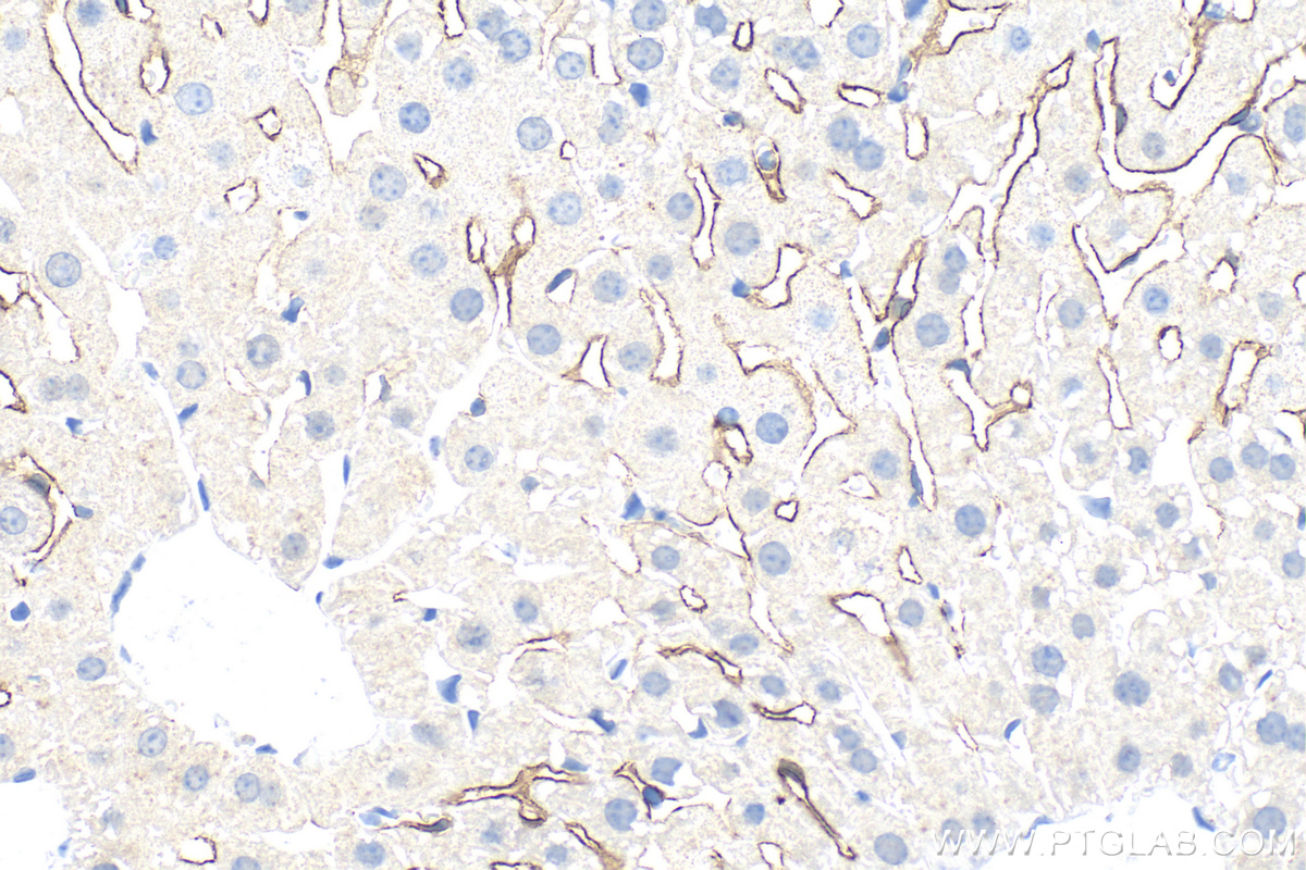 IHC staining of mouse liver using 34236-1-AP IHC staining of mouse liver using 34236-1-AP
