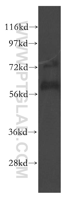 LYVE1 Polyclonal antibody