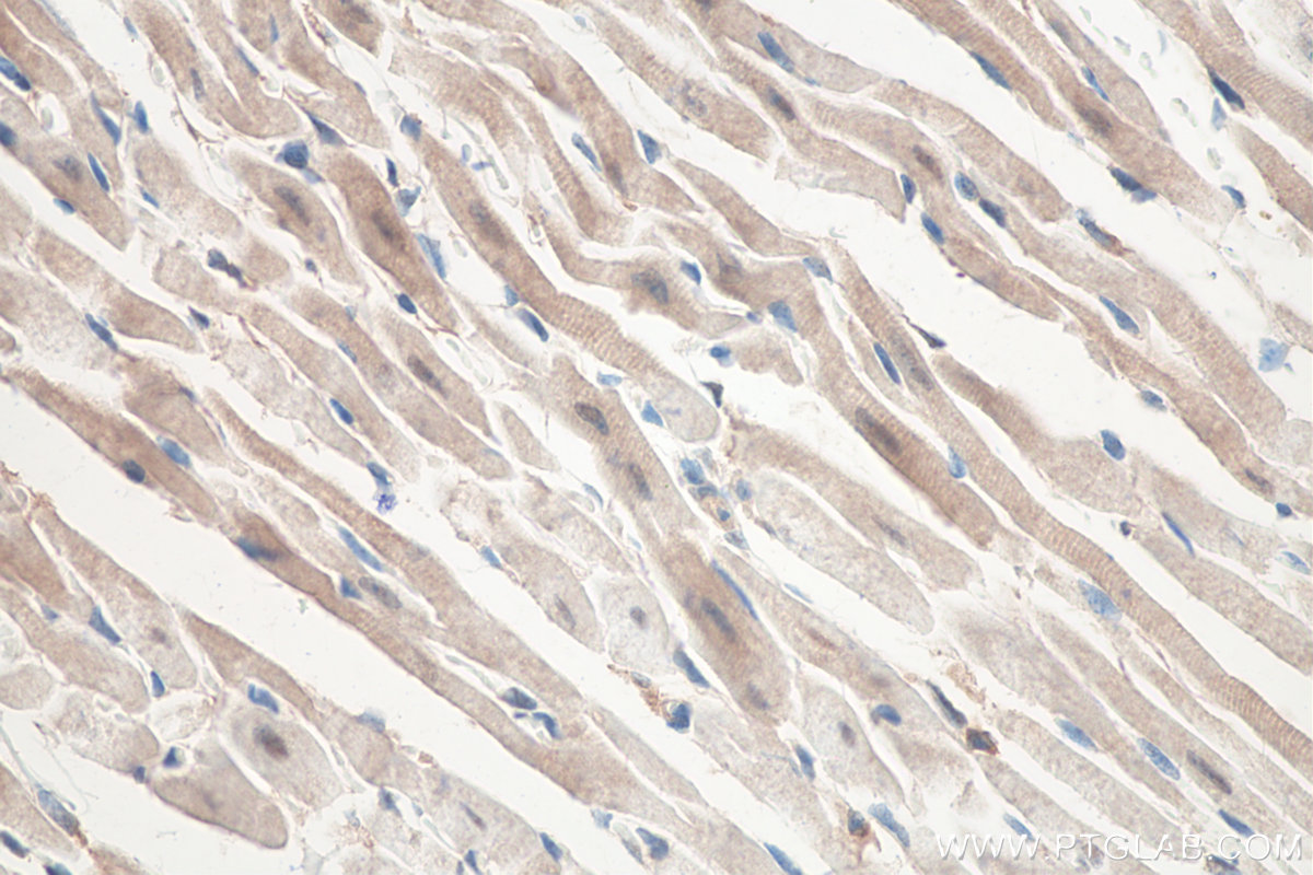 IHC staining of mouse heart using 15013-1-AP