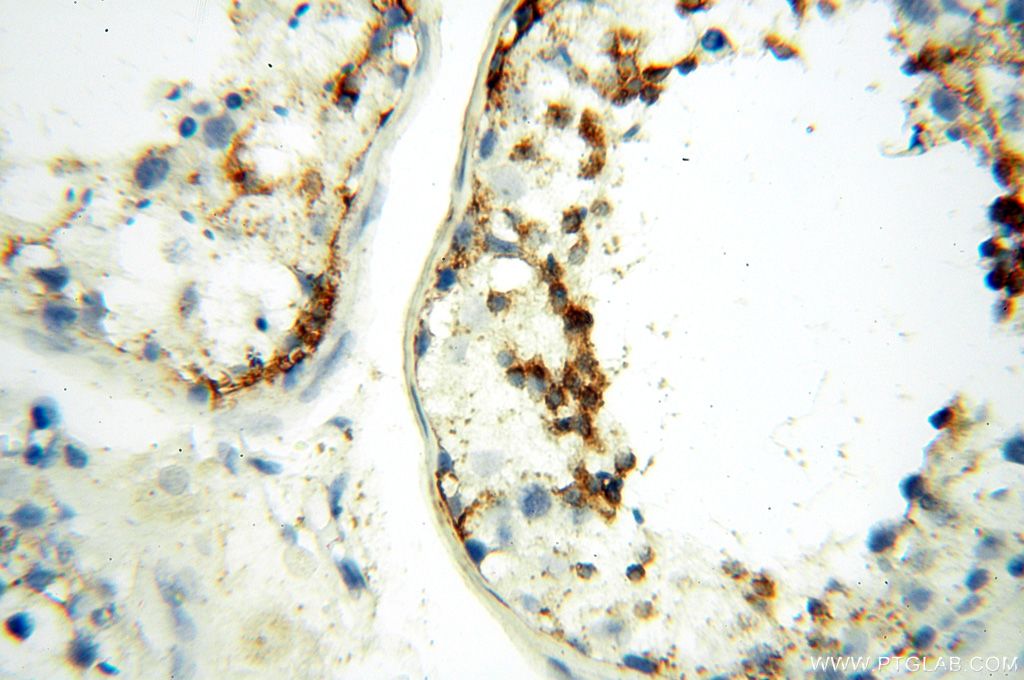 IHC staining of human testis using 17207-1-AP