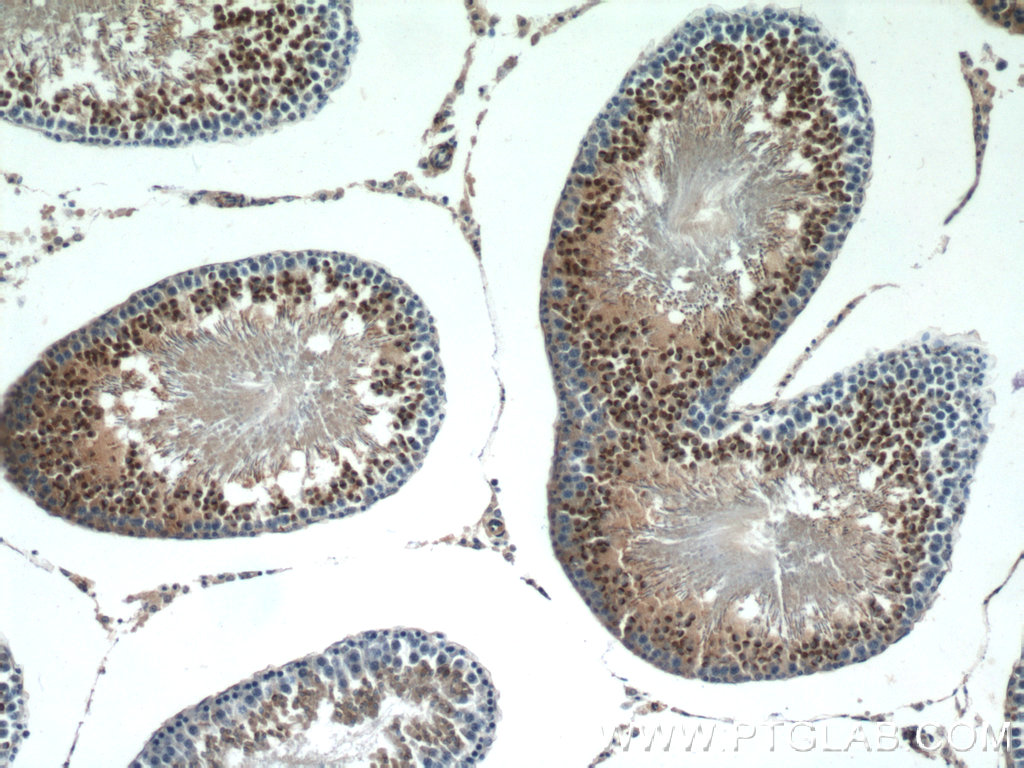 IHC staining of rat testis using 11922-1-AP