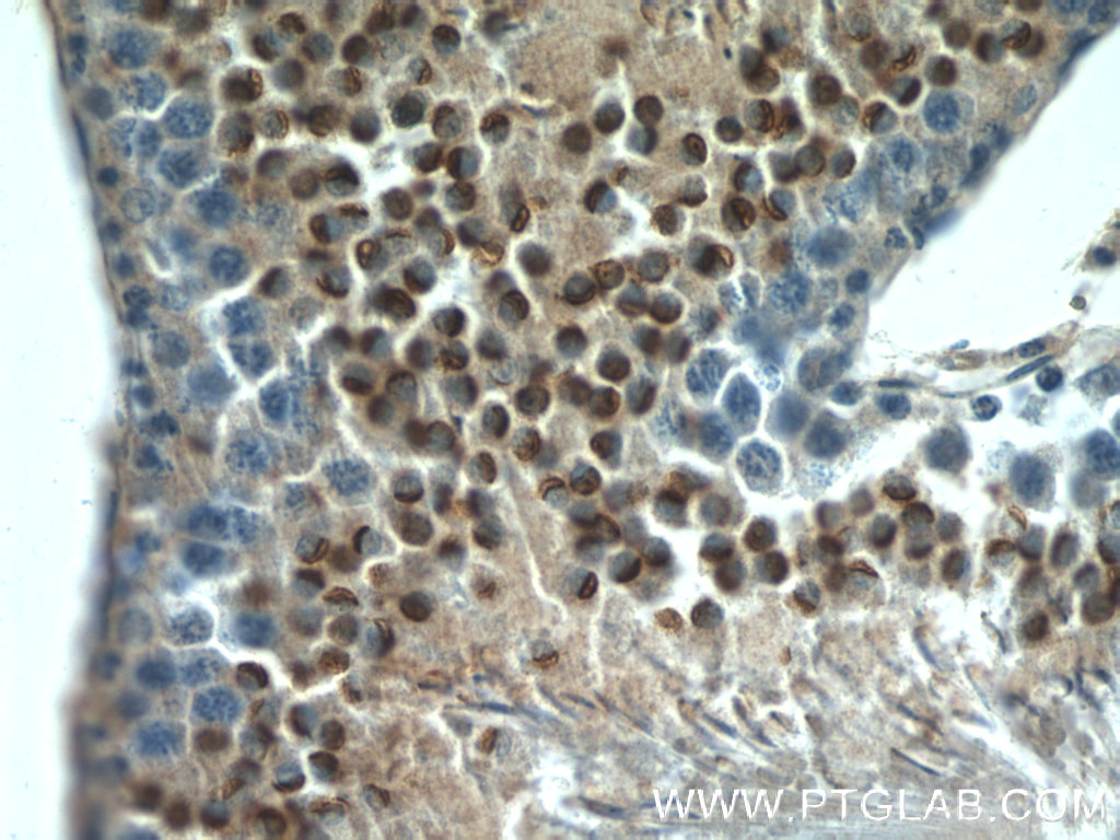 IHC staining of rat testis using 11922-1-AP