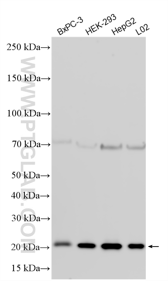WB analysis using 14543-1-AP WB analysis using 14543-1-AP