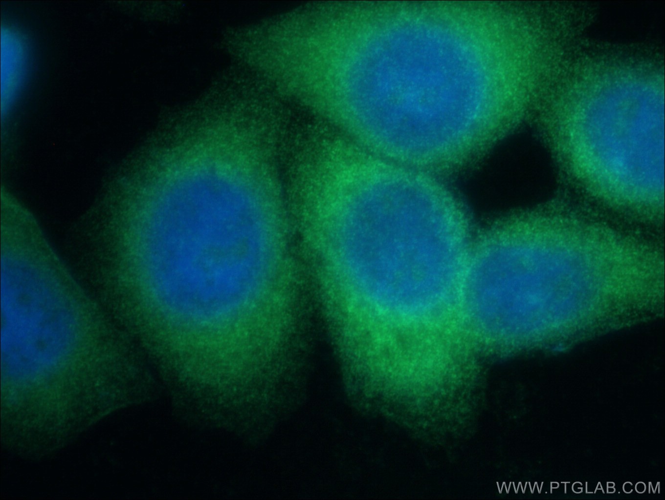 IF Staining of HepG2 using 17073-1-AP