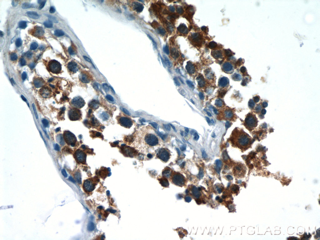 IHC staining of human testis using 17073-1-AP