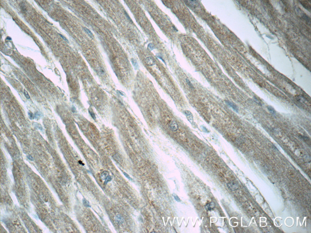 IHC staining of human heart using 17073-1-AP