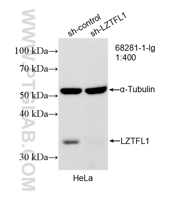 WB analysis of HeLa using 68281-1-Ig (same clone as 68281-1-PBS) WB analysis of HeLa using 68281-1-Ig (same clone as 68281-1-PBS)