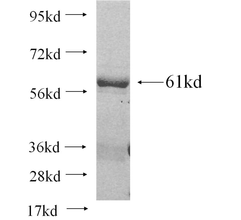 LZTFL1 fusion protein Ag10919 SDS-PAGE