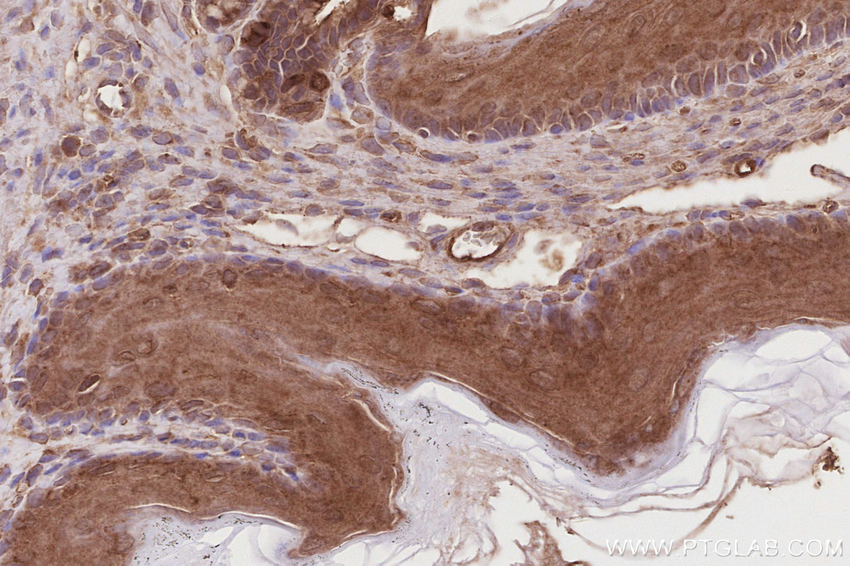 IHC staining of mouse stomach using 15677-1-AP