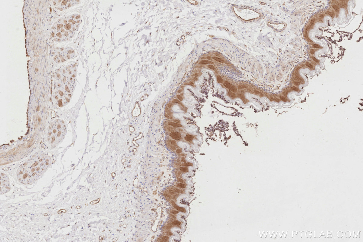 IHC staining of rat stomach using 15677-1-AP