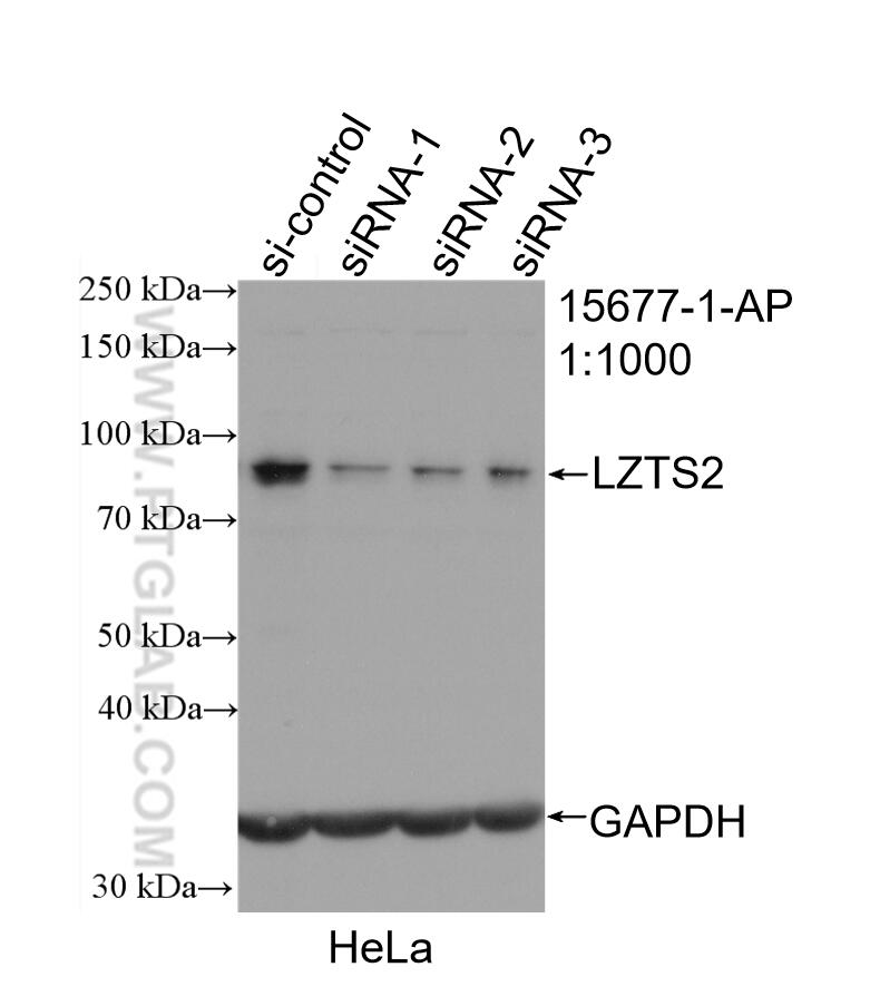 WB analysis of HeLa using 15677-1-AP