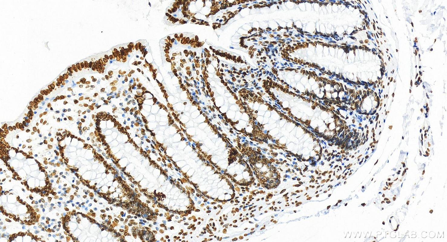 IHC staining of human colon using 81042-1-RR
