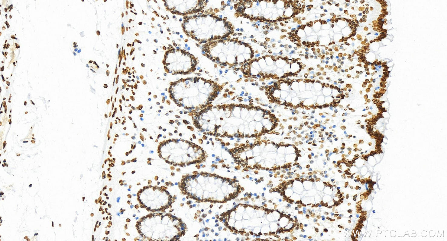 IHC staining of human colon using 81042-1-RR