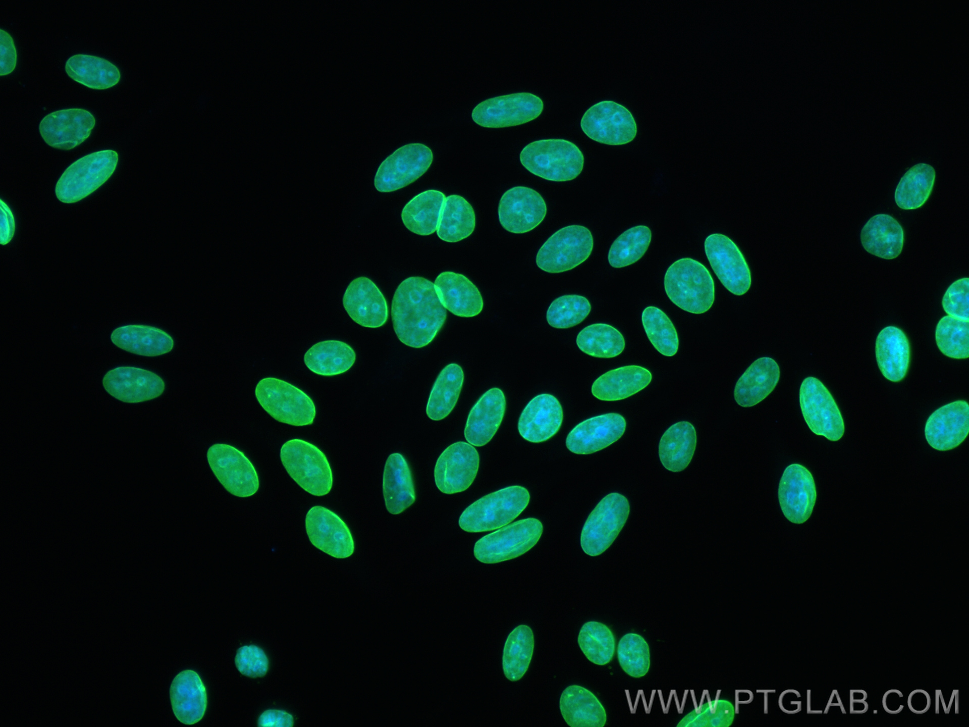 IF Staining of HepG2 using 81042-1-RR (same clone as 81042-1-PBS)