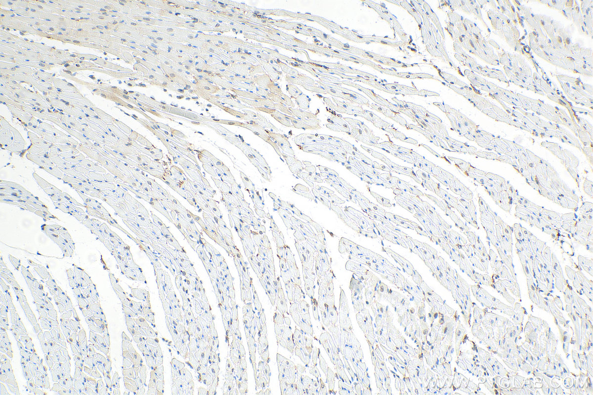 IHC staining of mouse heart using 81042-1-RR (same clone as 81042-1-PBS)