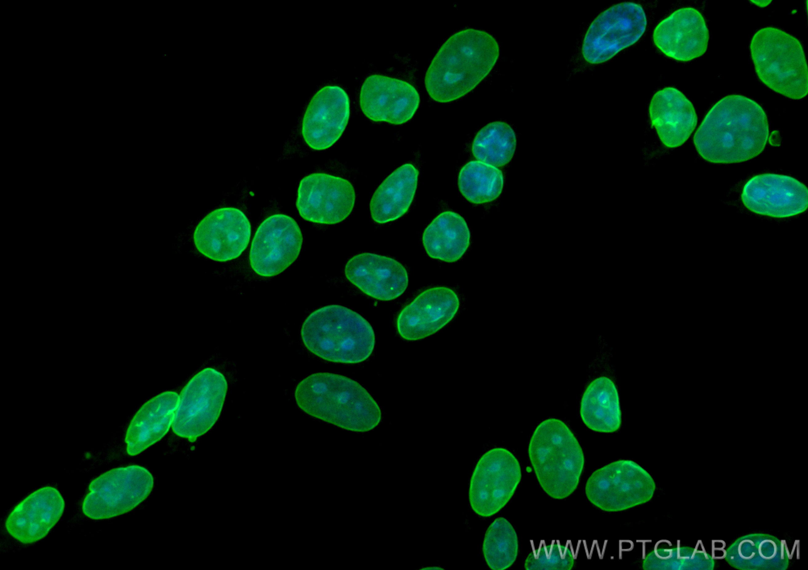 IF Staining of HepG2 using CL488-81042