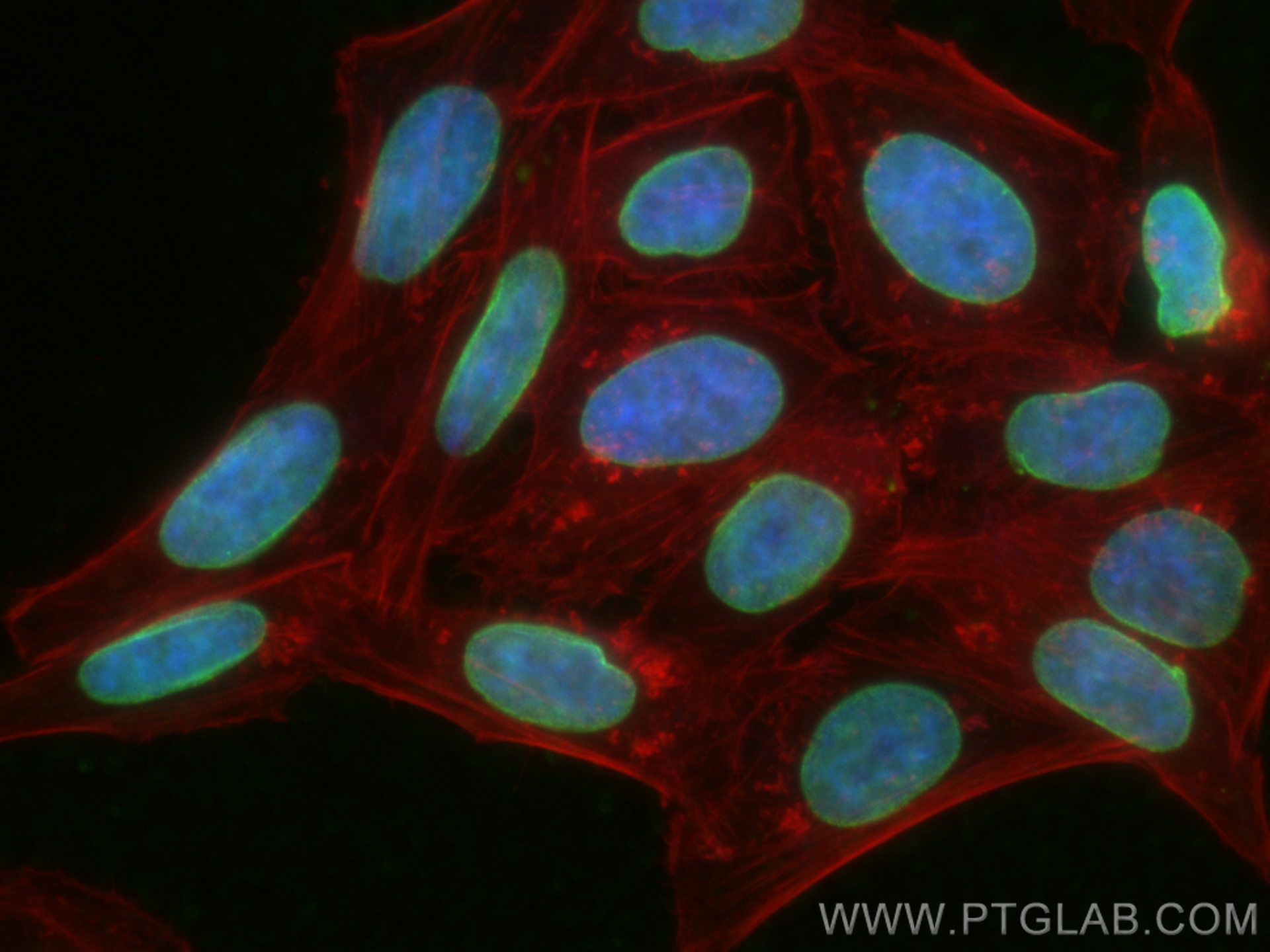 IF Staining of HepG2 using 80906-1-RR