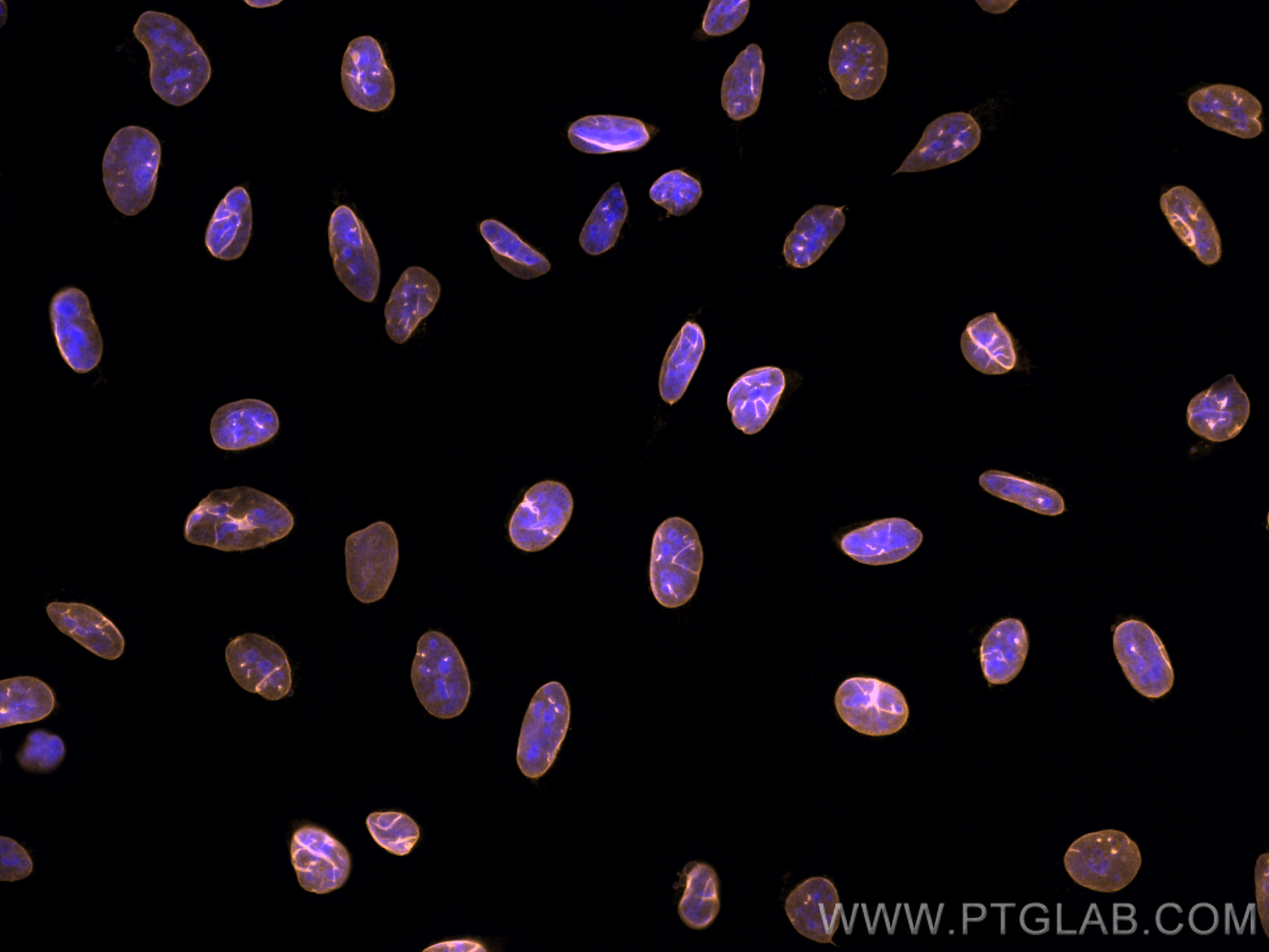 IF Staining of U2OS using CL555-66095