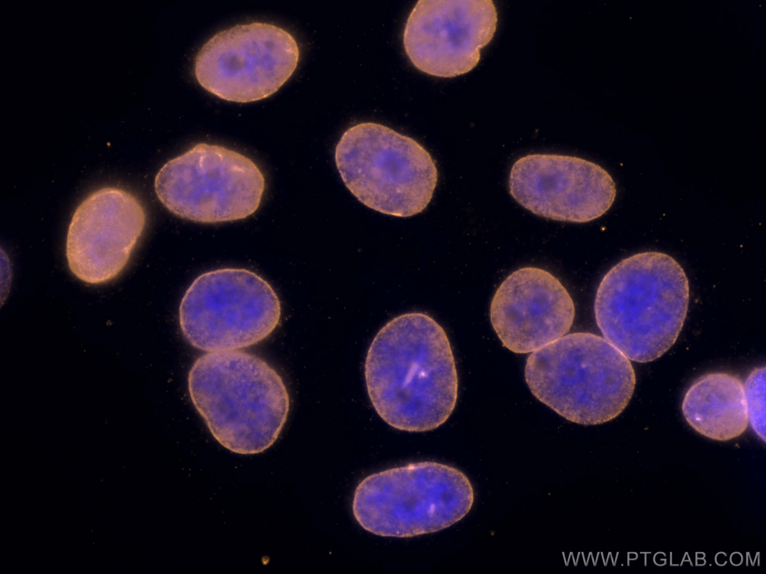 IF Staining of HepG2 using CL555-66095