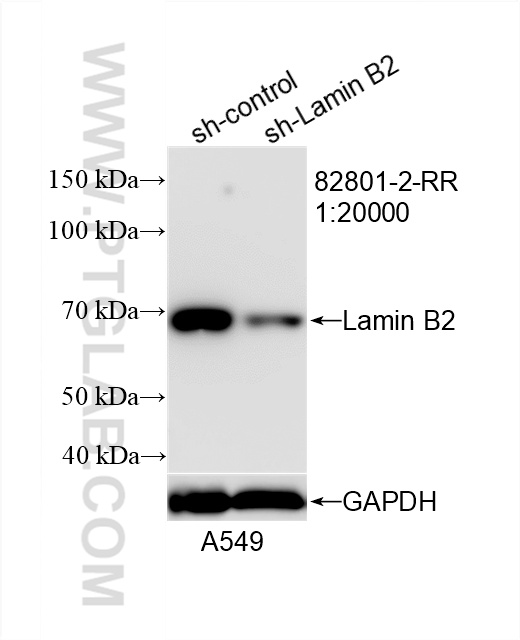 WB analysis of A549 using 82801-2-RR (same clone as 82801-2-PBS)