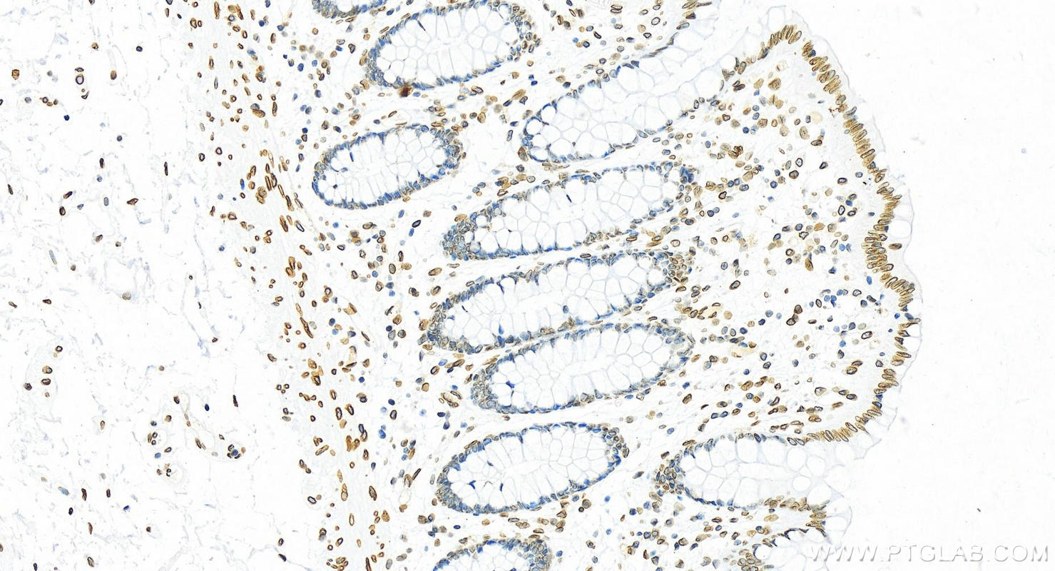 Immunohistochemical analysis of paraffin-embedded human colon tissue slide using <a class='green' href='/productredirect?CatalogNo=82801-4-RR' target='_blank'>82801-4-RR</a> (Lamin B2 antibody) at dilution of 1:2000 (under 20x lens). Heat mediated antigen retrieval with Tris-EDTA buffer (pH 9.0). This data was developed using the same antibody clone with 82801-4-PBS in a different storage buffer formulation. IHC staining of human colon using 82801-4-RR (same clone as 82801-4-PBS)