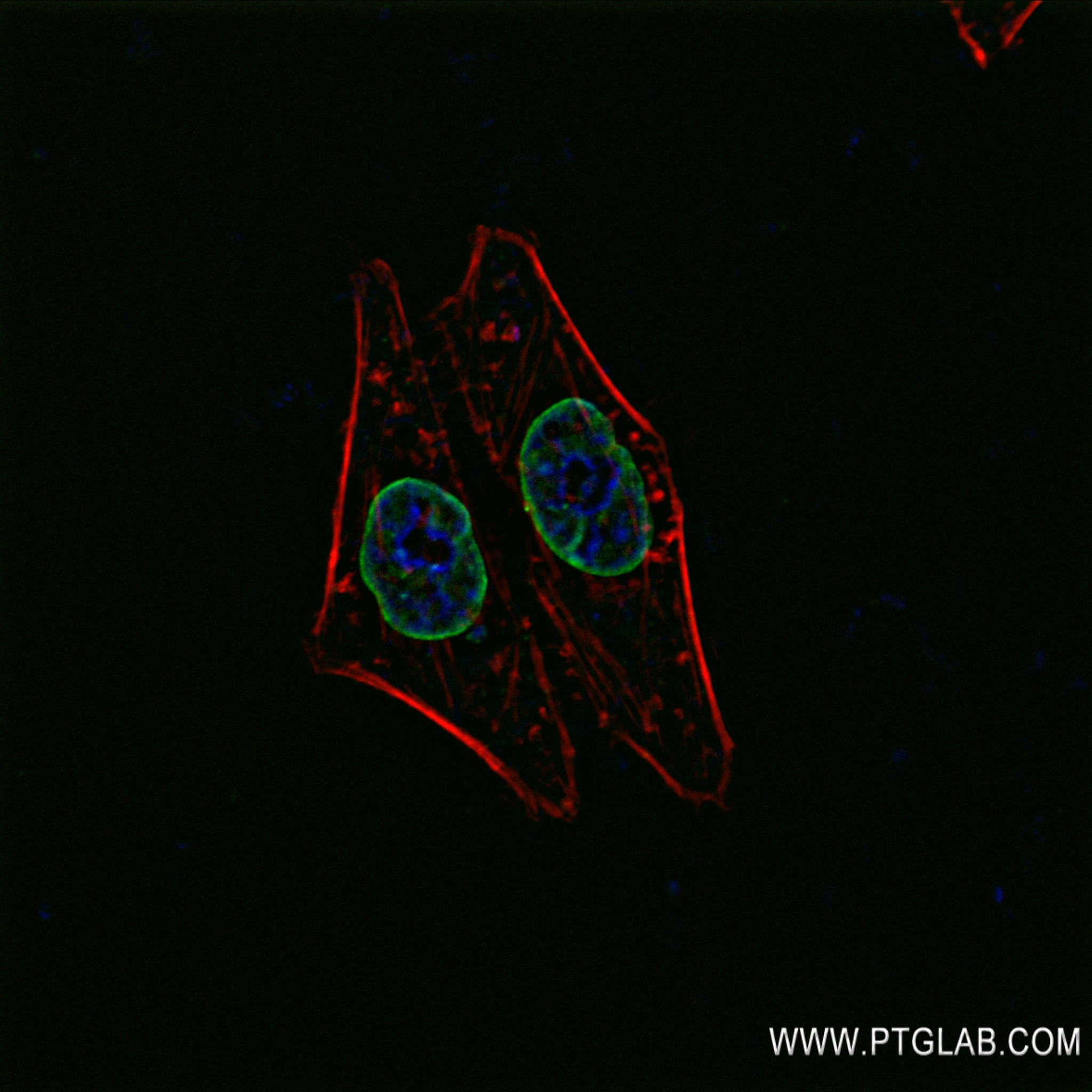 IF Staining of HepG2 using 82801-4-RR (same clone as 82801-4-PBS)