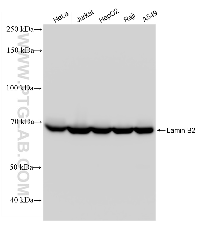 WB analysis using 82801-4-RR (same clone as 82801-4-PBS)