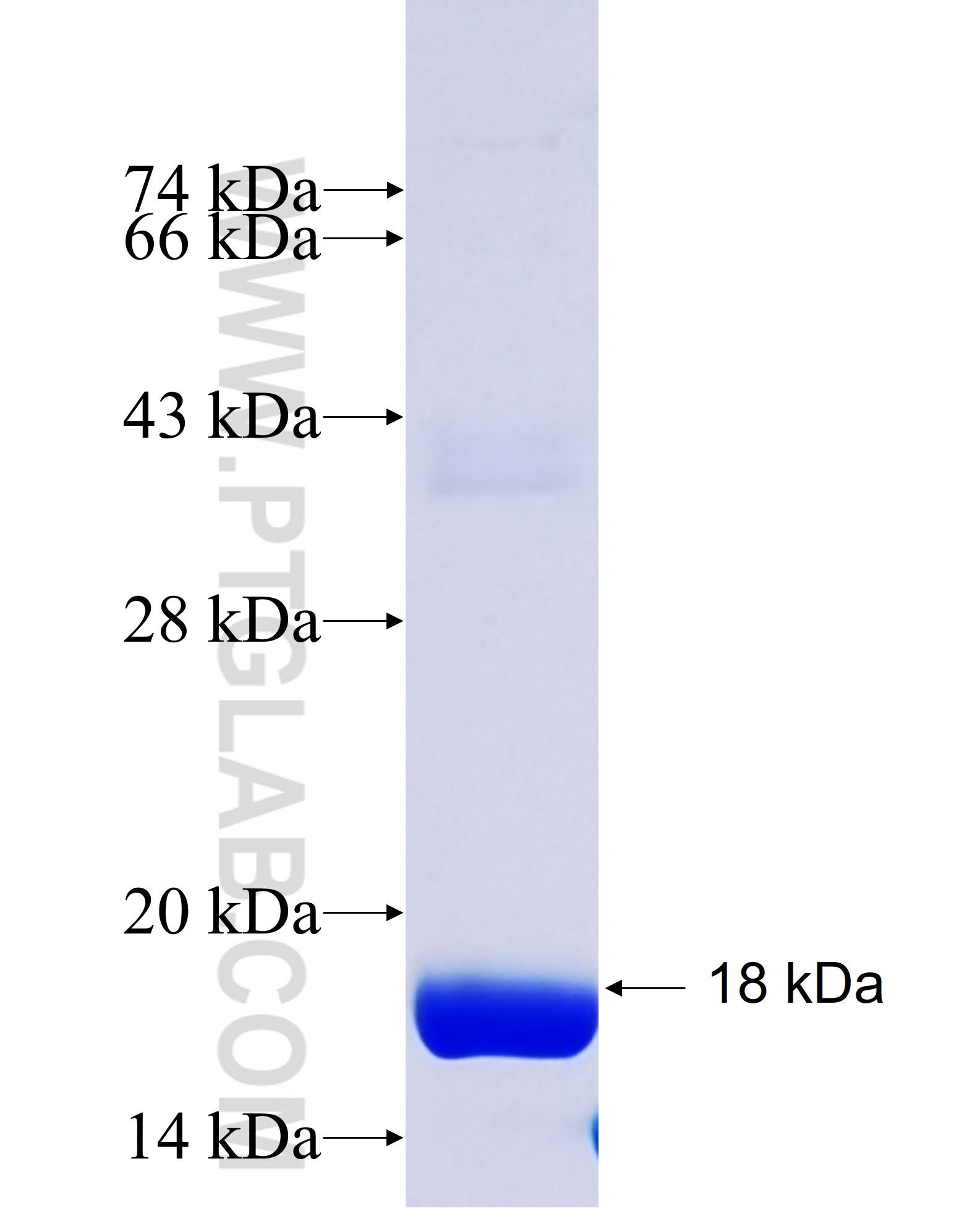 Leptin fusion protein Ag28723 SDS-PAGE Leptin fusion protein Ag28723 SDS-PAGE