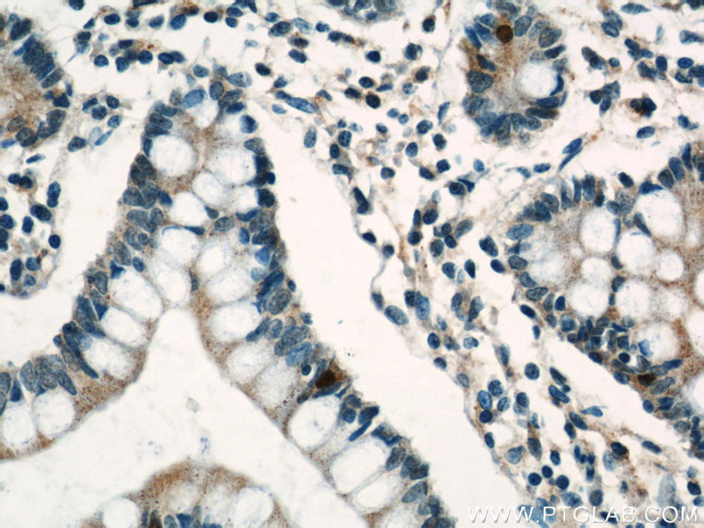 IHC staining of human small intestine using 16177-1-AP