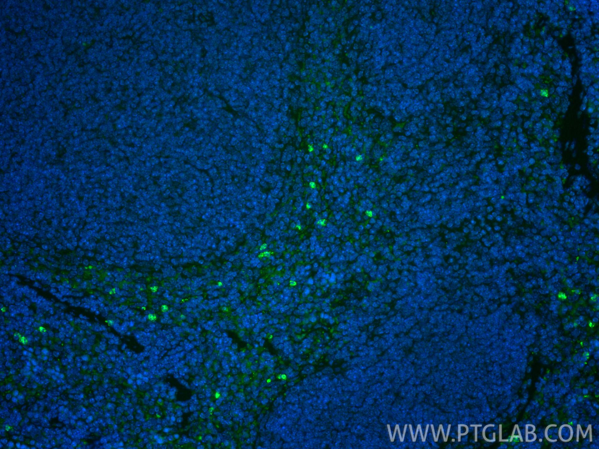IF Staining of mouse spleen using 31721-1-AP IF Staining of mouse spleen using 31721-1-AP