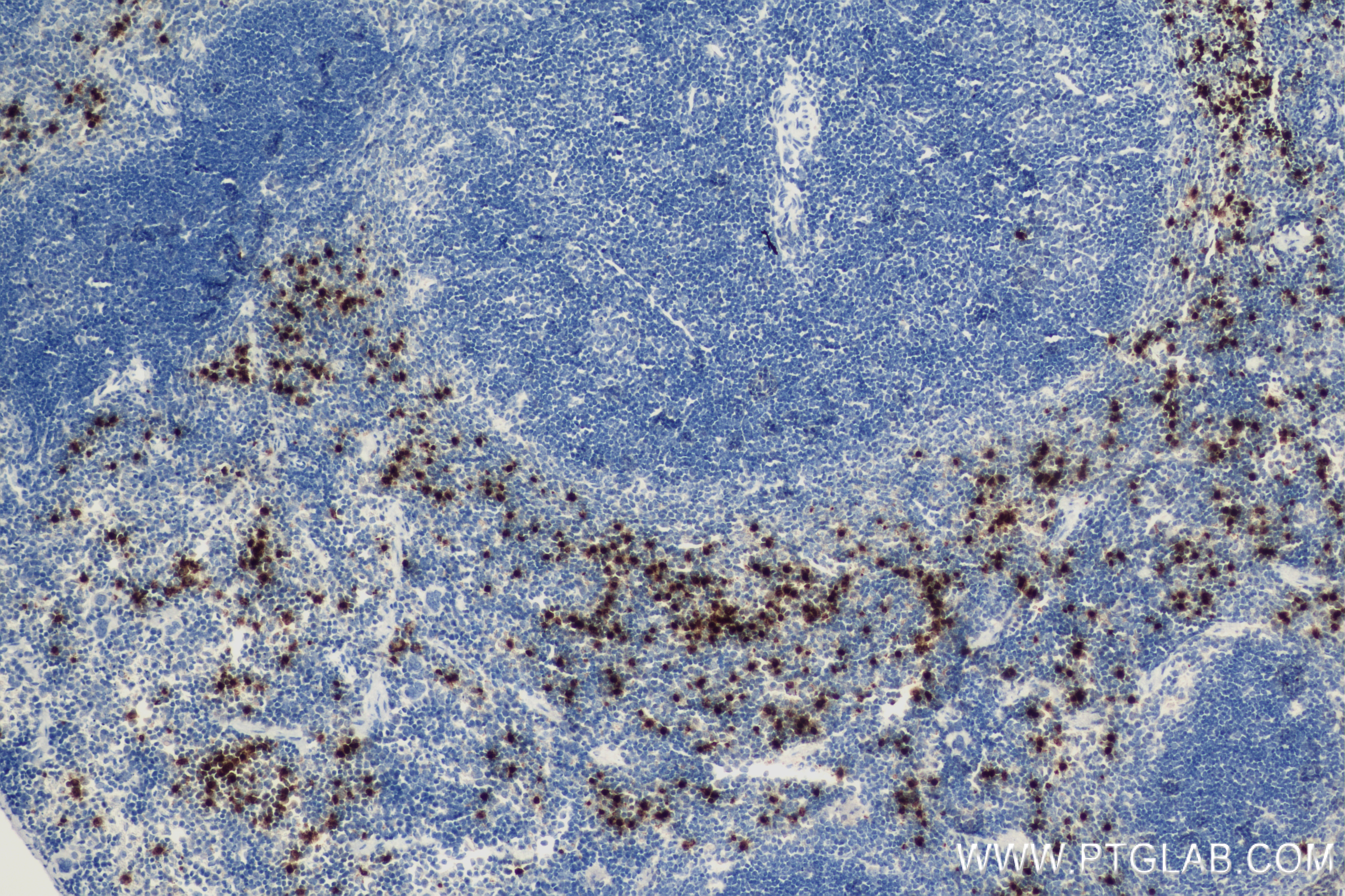 IHC staining of mouse spleen using 83853-2-RR