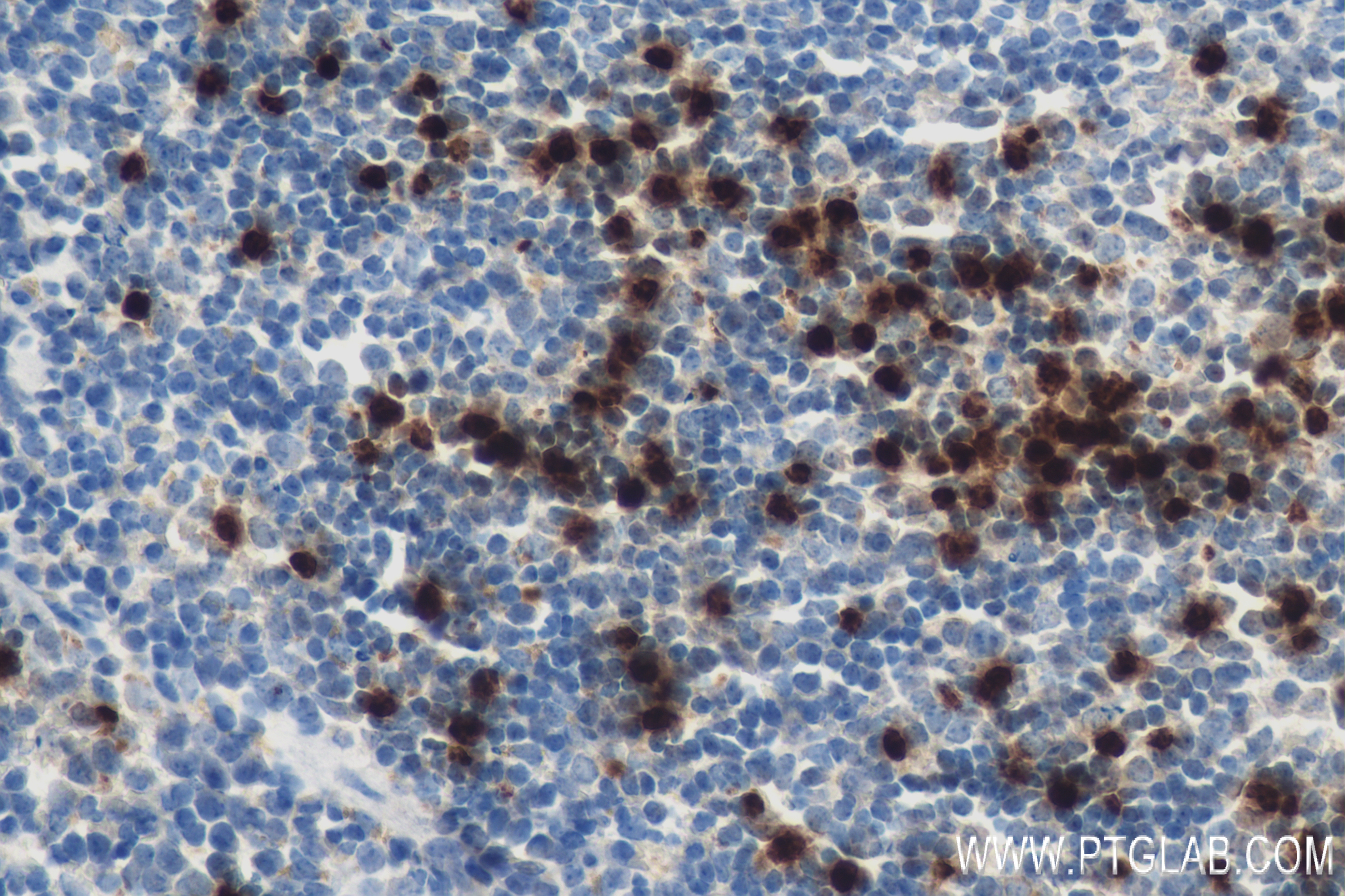 IHC staining of mouse spleen using 83853-2-RR
