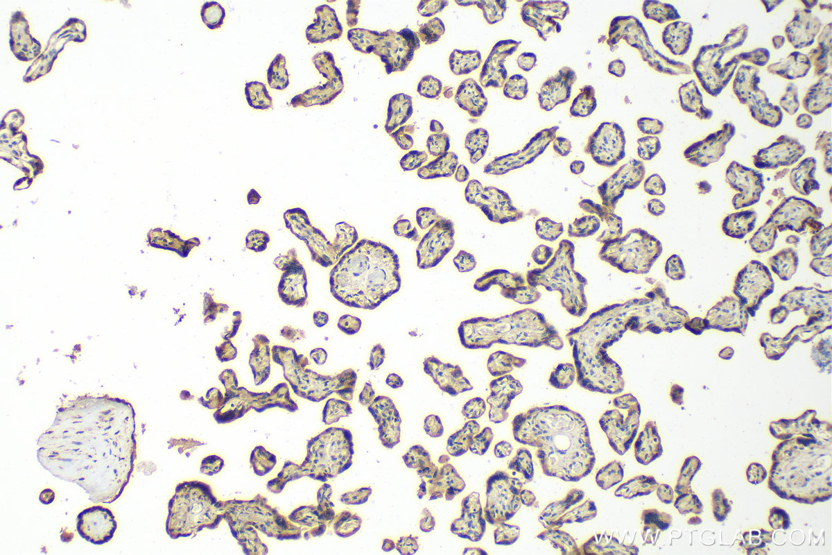 IHC staining of human placenta using 30675-1-AP