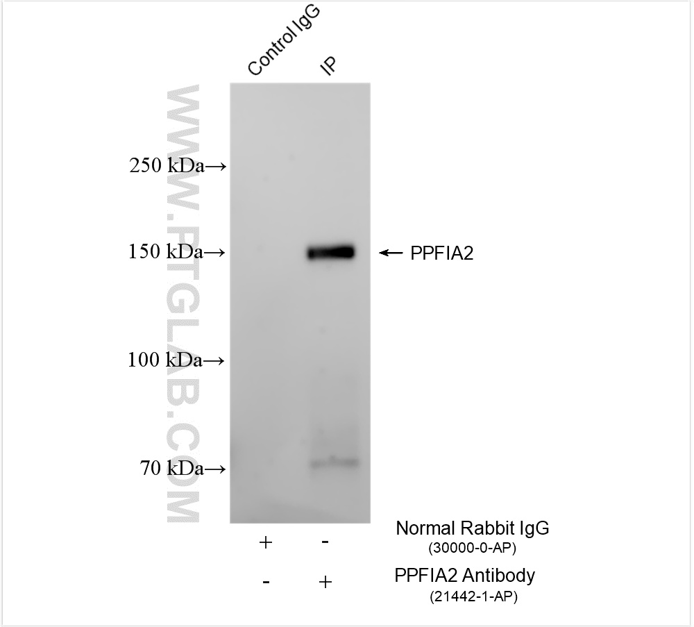 IP experiment of mouse brain using 21442-1-AP