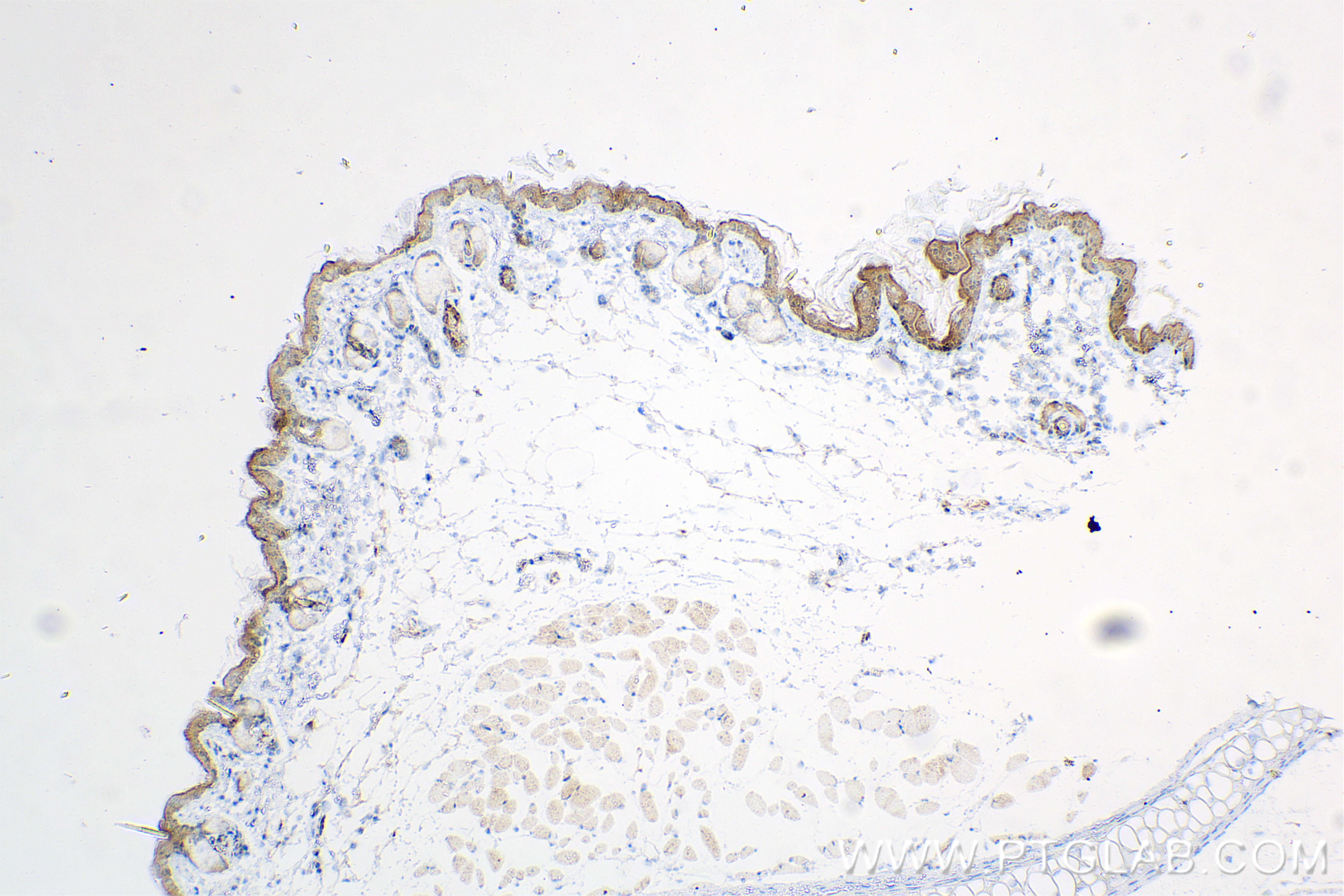IHC staining of mouse skin using 83865-1-RR