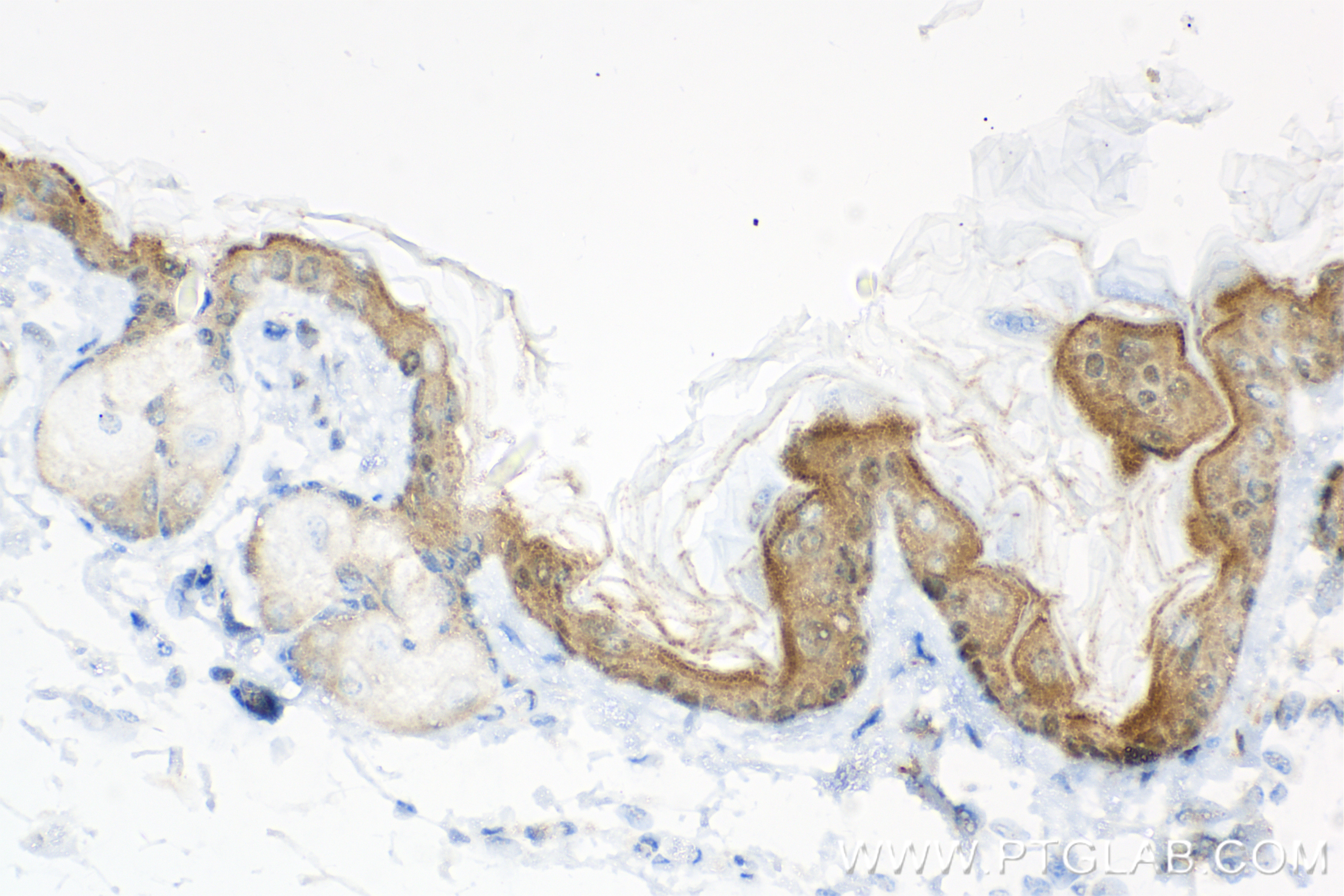 IHC staining of mouse skin using 83865-1-RR