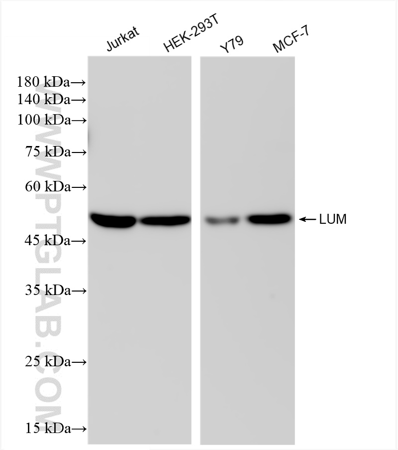 WB analysis using 85343-1-RR