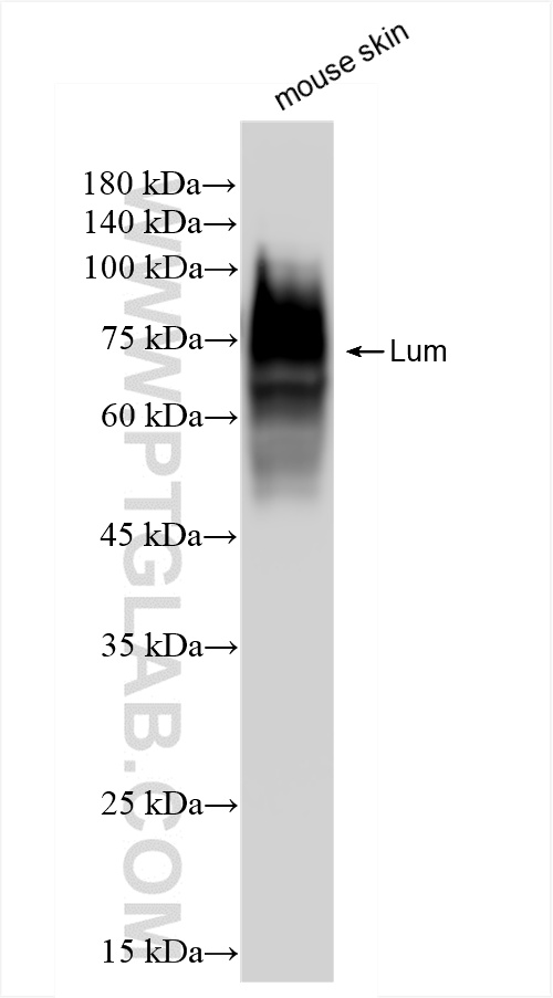 WB analysis of mouse skin using 86082-3-RR