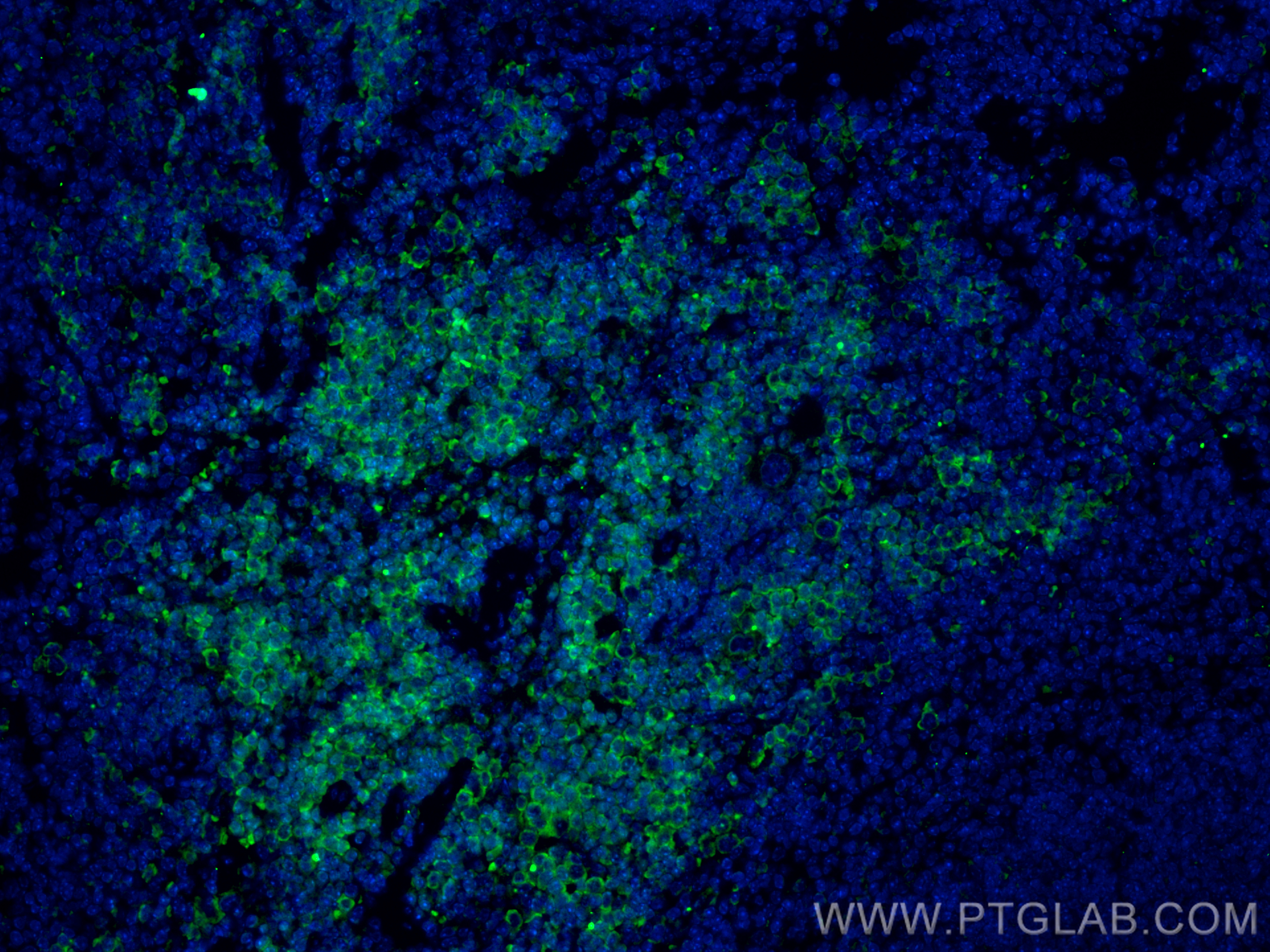 IF Staining of mouse spleen using CL488-10677