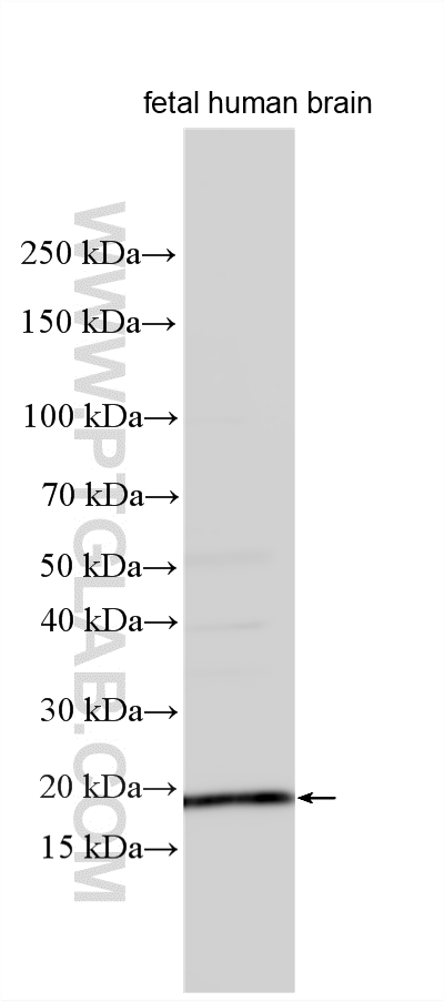 WB analysis using 33363-1-AP WB analysis using 33363-1-AP