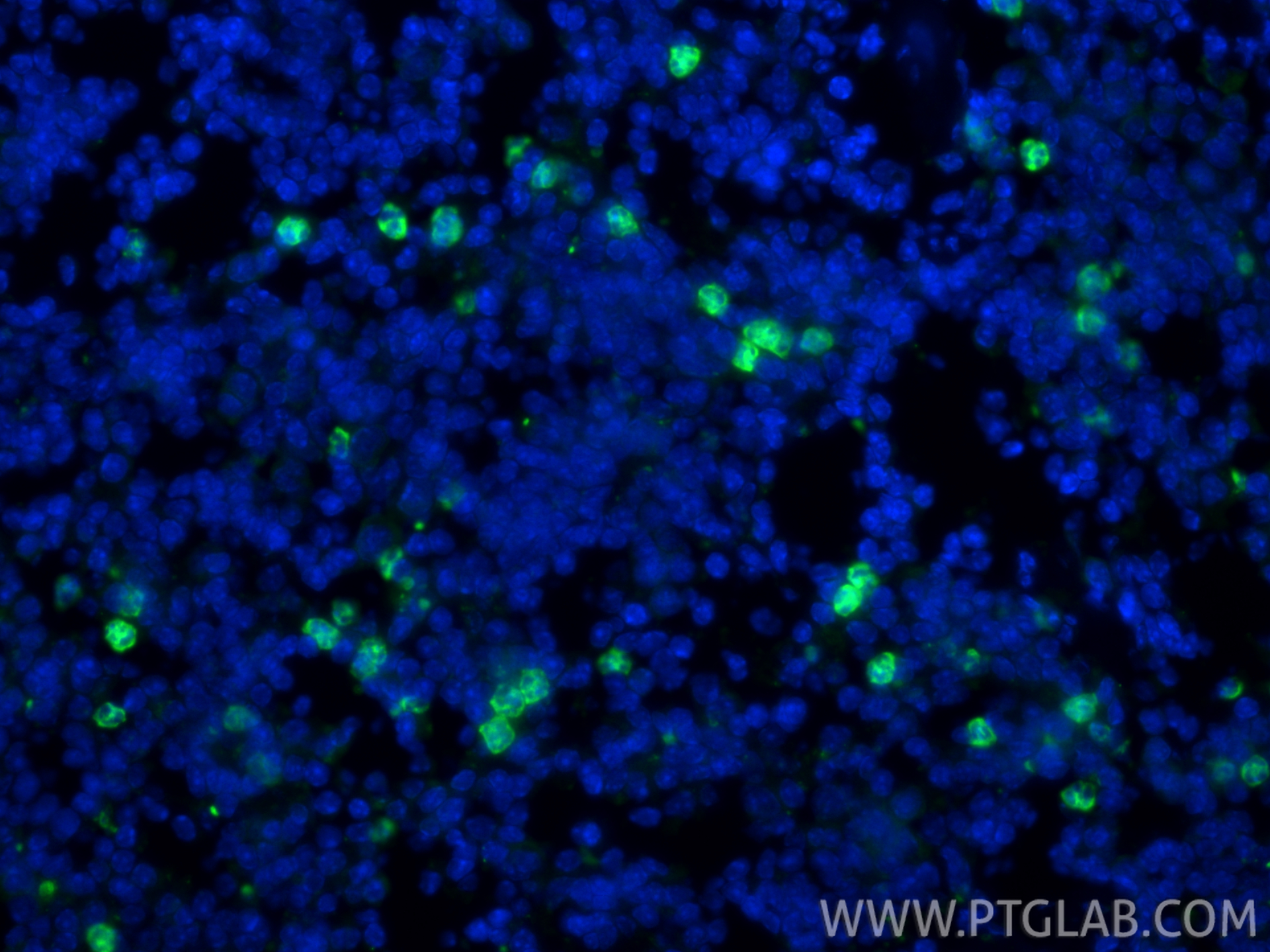 IF Staining of mouse spleen using 32346-1-AP IF Staining of mouse spleen using 32346-1-AP