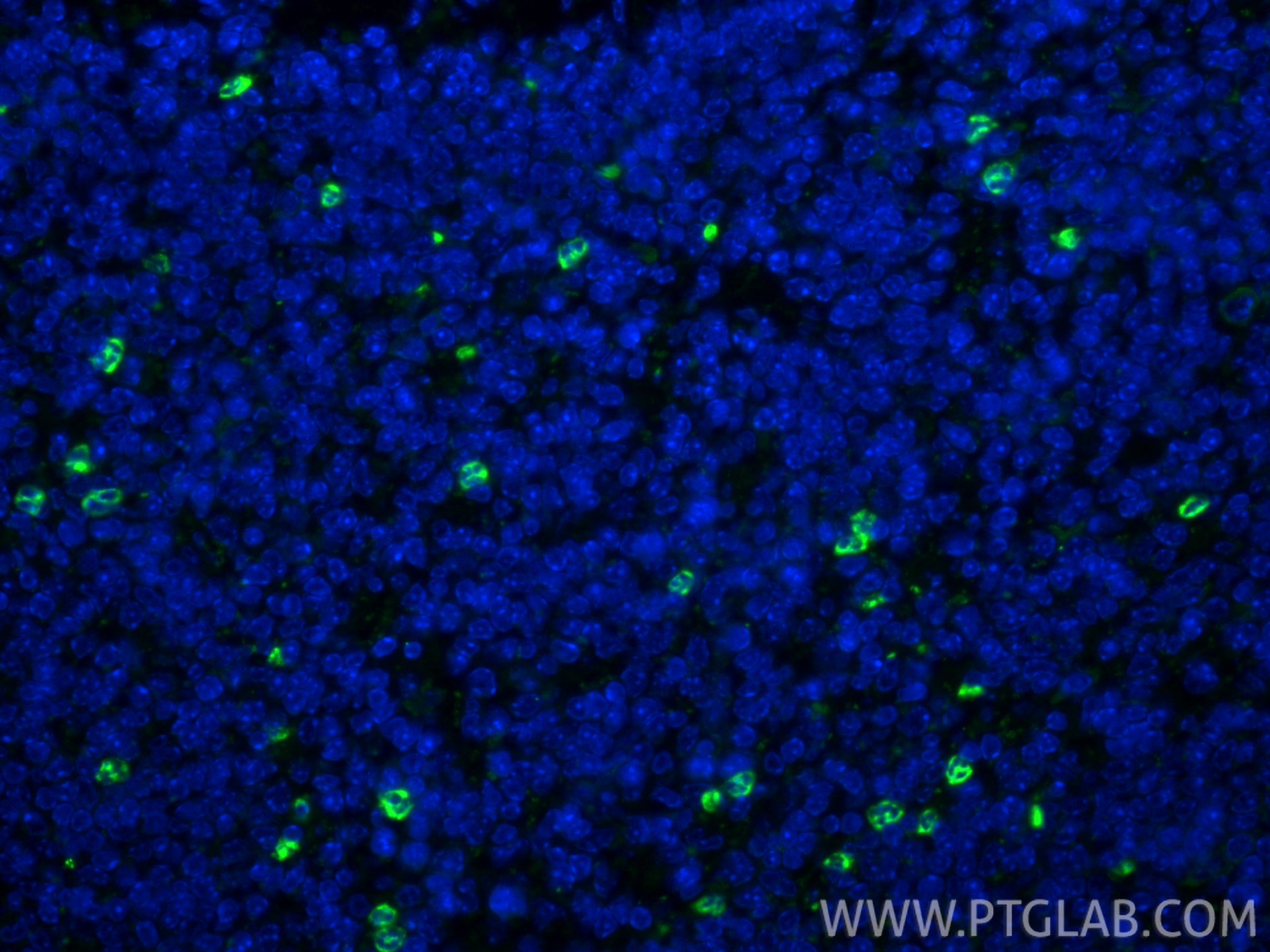 IF Staining of mouse spleen using 32346-1-AP IF Staining of mouse spleen using 32346-1-AP