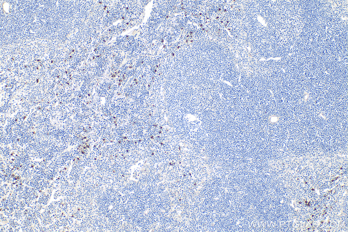 IHC staining of mouse spleen using 32346-1-AP