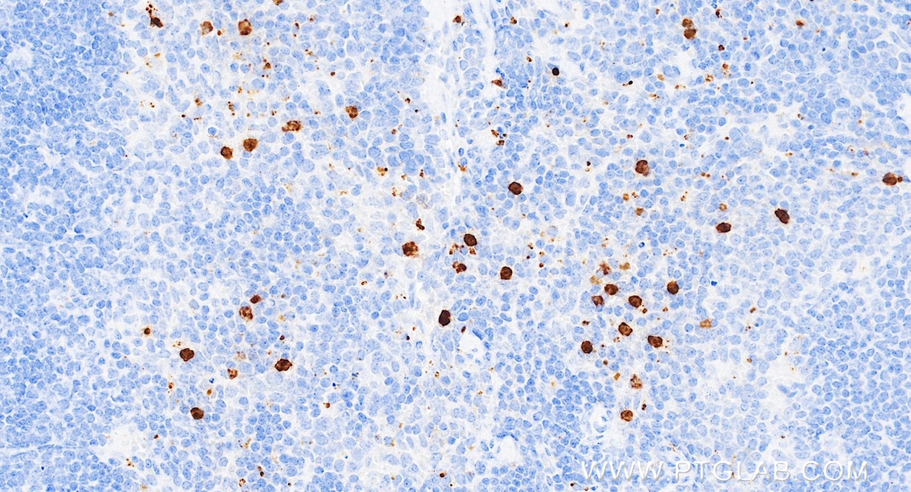 IHC staining of mouse spleen using 84820-5-RR IHC staining of mouse spleen using 84820-5-RR