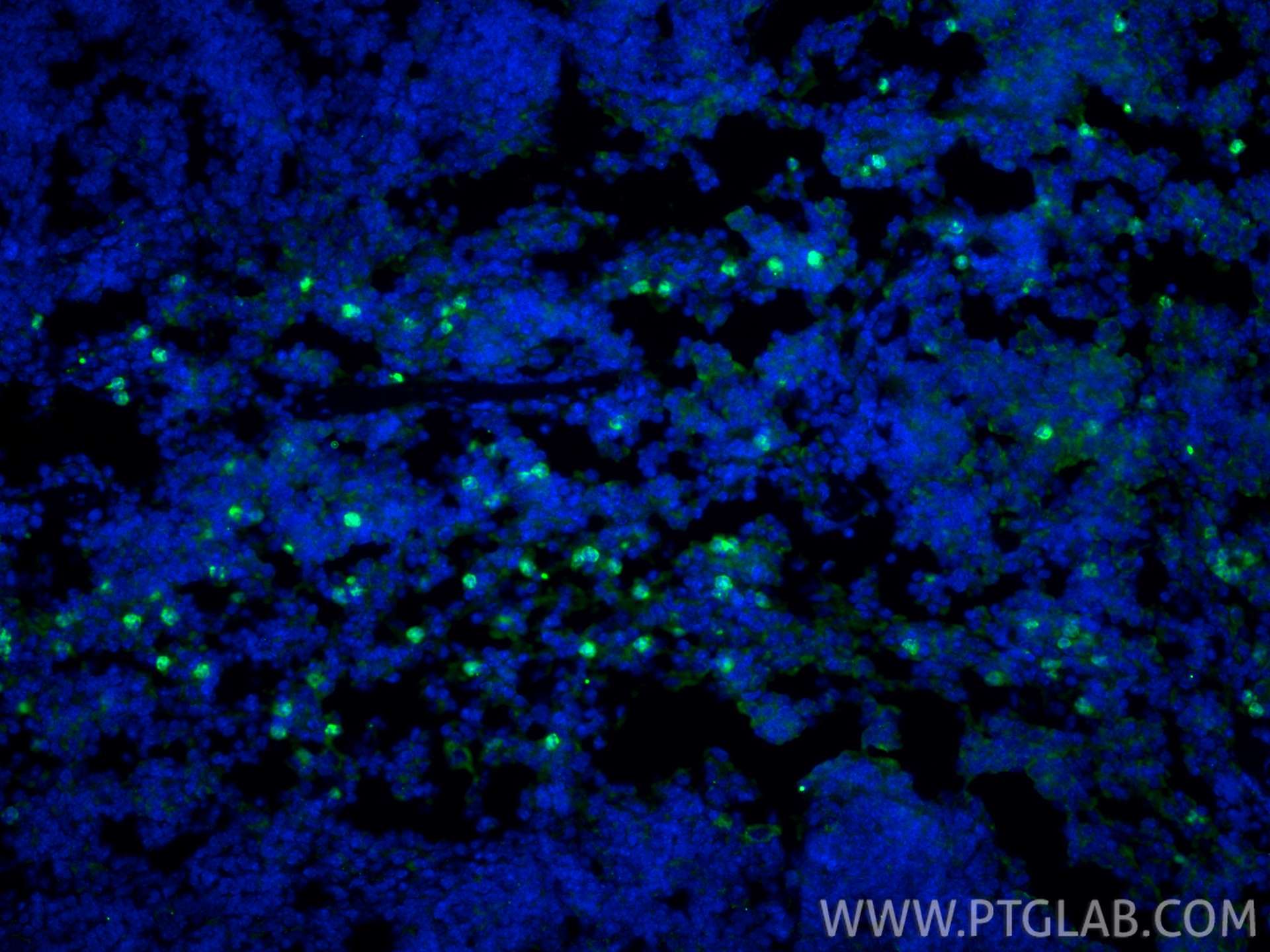 IF Staining of mouse spleen using 98284-1-RR IF Staining of mouse spleen using 98284-1-RR