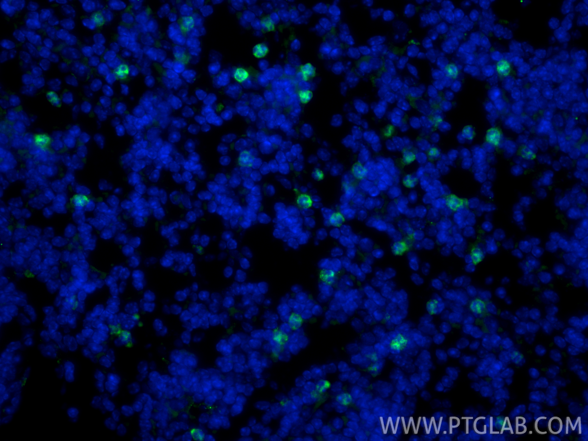 IF Staining of mouse spleen using 98284-1-RR IF Staining of mouse spleen using 98284-1-RR